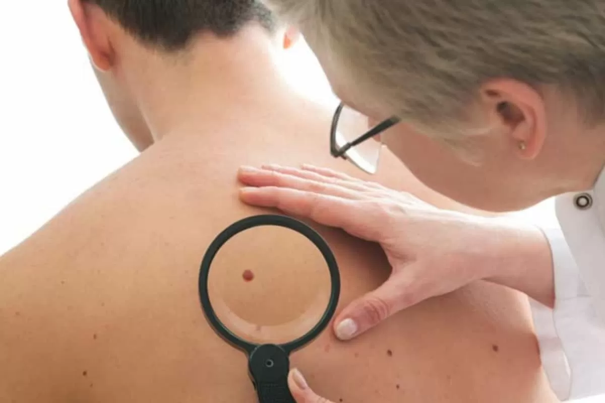 Stage 1 Cancer Symptoms: 7 Early Signs You Should Never Ignore