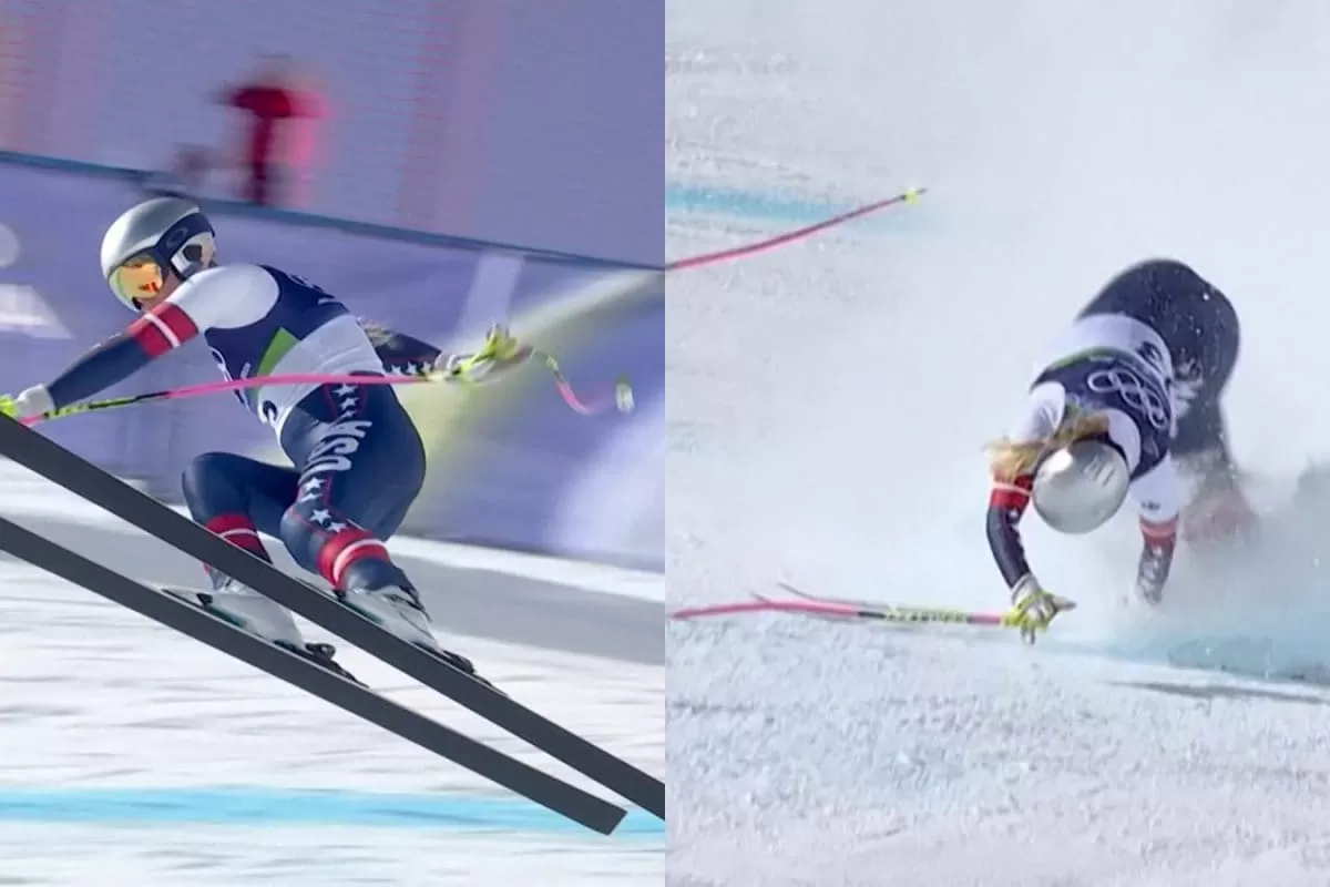 Vonn Left Broken: US Skiing Legend Undergoes Surgery After Horror Crash At Milano-Cortina Games